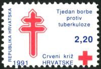 HRVAŠKA 1991 TUBERKULOZA MEDICINA BOLEZNI ** Mi ZD-12 ** znamka (15)