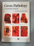 Anatomy and surgery of the cavernous sinus